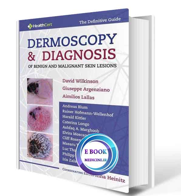 دانلود کتاب Dermoscopy and Diagnosis of Benign and Malignant Skin Lesions2020( epub+PDF)